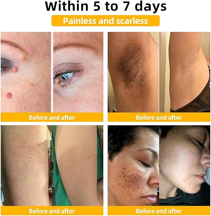 Bee Venom Skin Treatment Cream,Repair Maximum Strength for All Skin Types (1PCS)